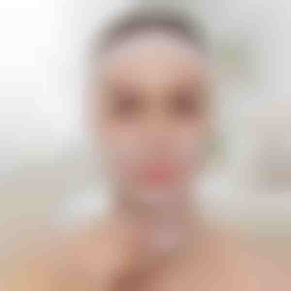 Fascia lifting per scolpire il viso | KIMLIFT