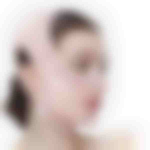 Fascia lifting viso e definizione della linea mandibolare | KIMLIFT